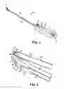Fig. 02 - Implants, tools, and methods for treatments of pelvic conditions