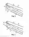 Fig. 03 - Implants, tools, and methods for treatments of pelvic conditions