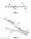 Fig. 04 - Implants, tools, and methods for treatments of pelvic conditions