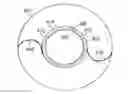 Fig. 01 - Method for creating incisions to improve intraocular lens placement
