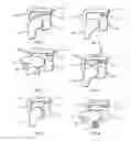 Fig. 02 - Tissue Positioning Device
