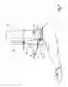 Fig. 08 - Surgical method and instrumentation assembly for positioning an ankle prosthesis