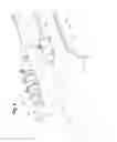 Fig. 06 - Stent graft delivery device pre-loaded with a single wire for device tracking and cannulation