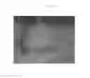 Fig. 02 - Emulsions or microemulsions for use in endoscopic mucosal resectioning and/or endoscopic submucosal dissection