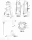 Fig. 03 - Bottle neck with internal embossments and method manufacture