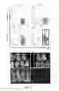 Fig. 02 - Method for producing pluripotent stem cell having improved chimera forming ability from primed pluripotent stem cell, and composition and combination therefor