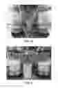 Fig. 07 - Enhanced Fermentation Process Using a Transglycosidase