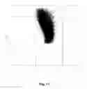 Fig. 12 - Method for determining volume and hemoglobin content of individual red blood cells