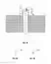 Fig. 04 - Wound closure device