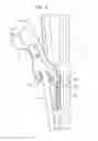Fig. 06 - Instruments and methods for tensioning a spinal tether