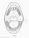 Fig. 02 - ORAL DENTAL SHIELD AND SYSTEM