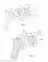 Fig. 02 - SHOULDER IMPLANT ASSEMBLY