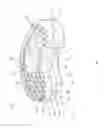 Fig. 02 - Self-pivoting spinal implant and associated instrumentation