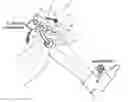 Fig. 01 - Medical registration apparatus and method for registering an axis