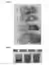 Fig. 02 - Prebiotic compositions and uses thereof