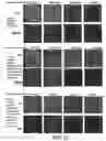 Fig. 22 - COMPOSITIONS AND METHODS FOR ALTERING HUMAN CUTANEOUS MICROBIOME TO INCREASE GROWTH OF STAPHYLOCOCCUS EPIDERMIDIS AND REDUCE STAPHYLOCOCCUS AUREUS PROLIFERATION