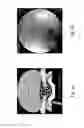 Fig. 02 - Compositions and methods for promoting the mineralization of biological tissue