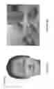 Fig. 06 - Injection paradigm for administration of botulinum toxins