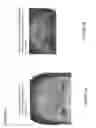 Fig. 07 - Injection paradigm for administration of botulinum toxins