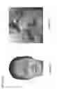 Fig. 08 - Injection paradigm for administration of botulinum toxins