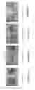 Fig. 09 - Injection paradigm for administration of botulinum toxins