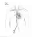 Fig. 02 - Cannula assembly for fitting a flow cannula for introducing, circulating or diverting flow media, and method for extracorporeal support of a patient with pulmonary hypertension or pulmonary insufficiency