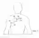 Fig. 02 - Automatic treatment of pain