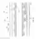 Fig. 09 - Balloon catheter