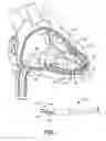 Fig. 02 - Interventional medical systems and associated tethering assemblies and methods