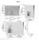 Fig. 06 - Methods and systems for treating neurological movement disorders