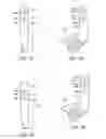 Fig. 36 - Interchangeable shaft system