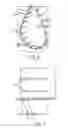 Fig. 05 - Tube to bulkhead bonded joint design