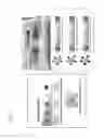 Fig. 02 - METHOD FOR SEPARATING MULTIPLE BIOLOGICAL MATERIALS