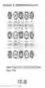 Fig. 28 - Pixel interpolation apparatus, imaging apparatus, pixel interpolation processing method, and integrated circuit