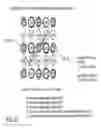 Fig. 33 - Pixel interpolation apparatus, imaging apparatus, pixel interpolation processing method, and integrated circuit