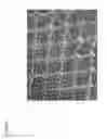 Fig. 08 - Electrodes for abdominal fetal electrocardiogram detection