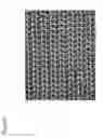 Fig. 09 - Electrodes for abdominal fetal electrocardiogram detection