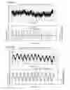 Fig. 09 - SENSOR DEVICE FOR DETECTING DISPLACEMENTS OF HUMAN'S BODY SURFACE ACCOMPANYING RESPIRATION