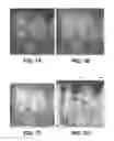 Fig. 06 - Periodontal disease detection system and method