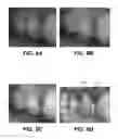 Fig. 07 - Periodontal disease detection system and method