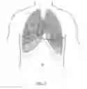 Fig. 07 - Medical device with acoustic sensor