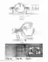 Fig. 02 - Methods for performing bi-planar fluoroscopy-guided surgical procedures