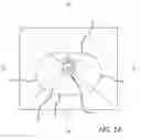 Fig. 02 - Multiple spinal surgical pathways systems and methods