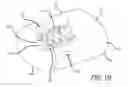 Fig. 06 - Multiple spinal surgical pathways systems and methods