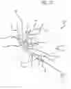 Fig. 08 - Multiple spinal surgical pathways systems and methods