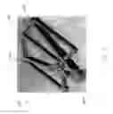Fig. 22 - Robotic endoscopic retractor for use in minimally invasive surgery