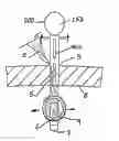 Fig. 01 - APPARATUS FOR INSERTING A SURGICAL DEVICE AT LEAST PARTIALLY THROUGH A WOUND OPENING