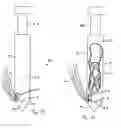 Fig. 06 - APPARATUS FOR INSERTING A SURGICAL DEVICE AT LEAST PARTIALLY THROUGH A WOUND OPENING