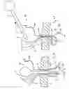 Fig. 40 - APPARATUS FOR INSERTING A SURGICAL DEVICE AT LEAST PARTIALLY THROUGH A WOUND OPENING
