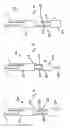 Fig. 86 - APPARATUS FOR INSERTING A SURGICAL DEVICE AT LEAST PARTIALLY THROUGH A WOUND OPENING